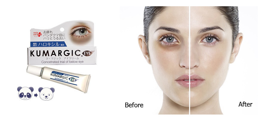 Kem giảm thâm quầng mắt Kumargic Eye là sản phẩm nội địa rất nổi tiếng ... Kem giảm quầng thâm mắt Kumargic - giảm thâm quầng mắt và chống lão hóa da.